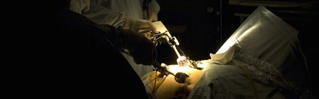 Endoskop-Lampen